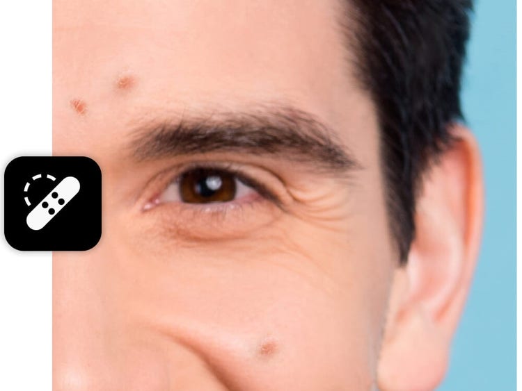 A zoomed in shot of the man's face focusing on blemishes., Picture