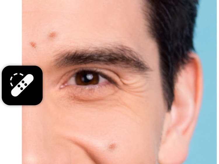 Uma foto ampliada do rosto de um homem com foco nas manchas.