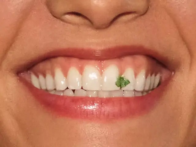Sorriso de uma mulher com algo preso nos dentes.