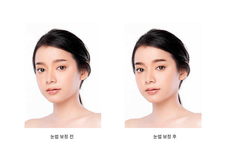속눈썹 보정 전 후 이미지