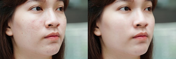 뉴럴 필터 적용 예시 전후 비교