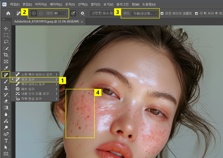 제거 도구로 피부 잡티 제거하기