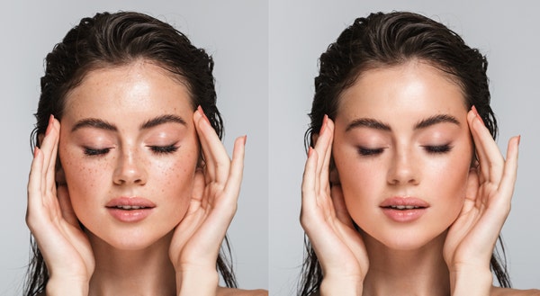 뉴럴 필터를 이용한 피부 사진 보정 전후