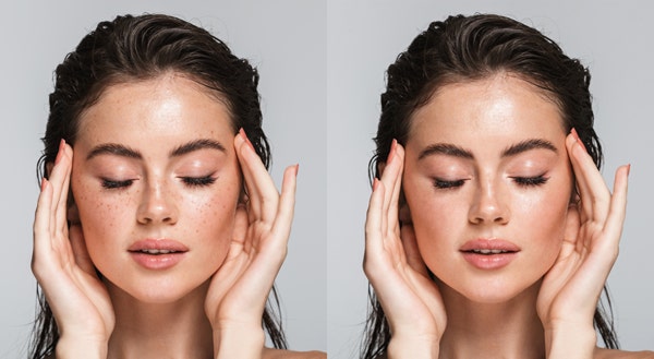 ‘스팟 복구 브러시’를 이용한 피부 사진 보정 전후