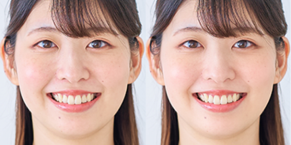 뉴럴 필터로 피부 보정하기 전후 비교